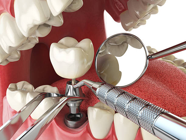 Best Emergency Dentist for Special Needs Patients in Adwolf, VA
